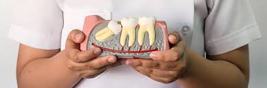 Best dental clinic in Vijayawada for wisdom teeth removal