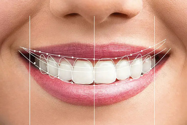 Full Mouth Rehabilitation benefits