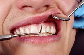 Best Gum treatment in Vijayawada