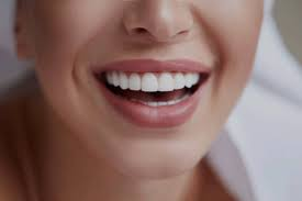 Ceramic veneers clinic near me in Vijayawada