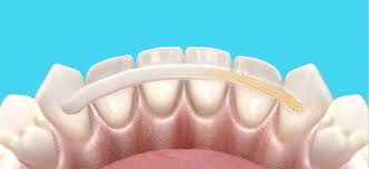 Best dental clinic near me for orthodontic splinting