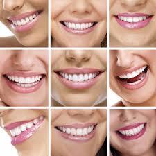 How much does a smile makeover typically cost?