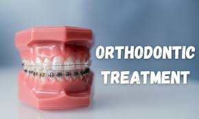 Best Orthodontic Treatment In Vijayawada