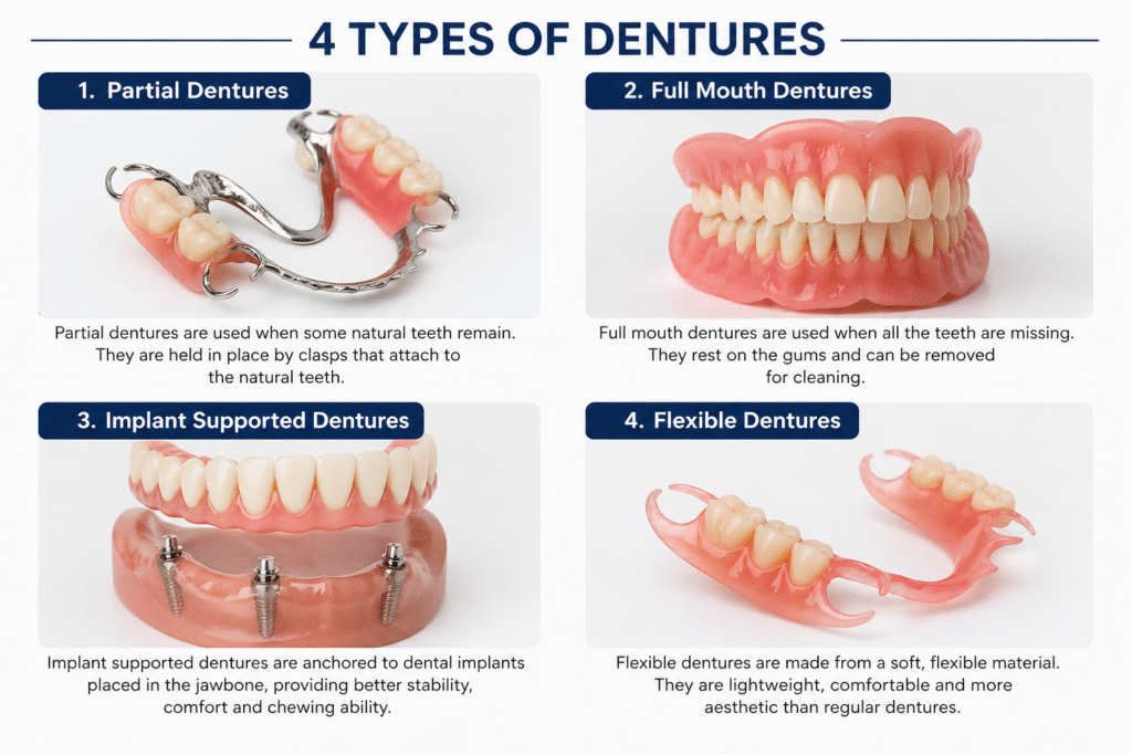 Types of Dentures